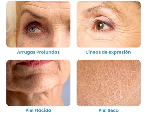 Rejuvenece tu Piel con Botox Premium: La Revolución Antienvejecimiento